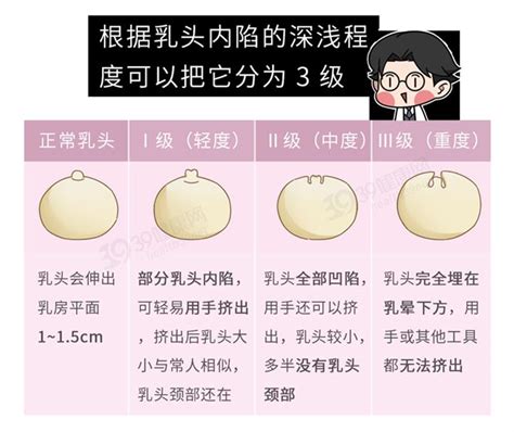 乳暈 長毛|乳頭內凹、長毛正常嗎？ 8類「乳頭形狀」你的是哪種 